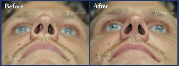 Rhinoplasty Clinic Thailand  and dermatology center