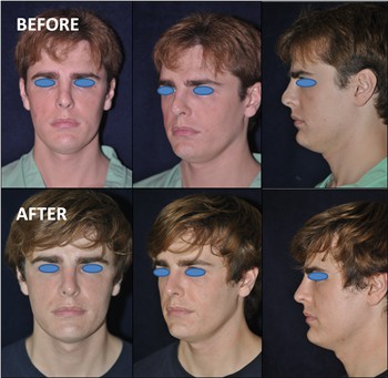 Rhinoplasty Clinic Thailand  and dermatology center