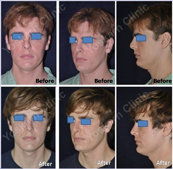 Rhinoplasty Thailand and dermatology center