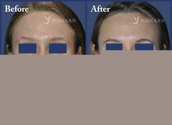 Rhinoplasty Clinic Thailand  and dermatology center