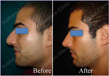 Rhinoplasty Clinic Thailand  and dermatology center