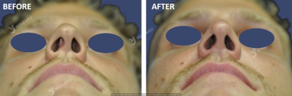 Rhinoplasty Clinic Thailand  and dermatology center