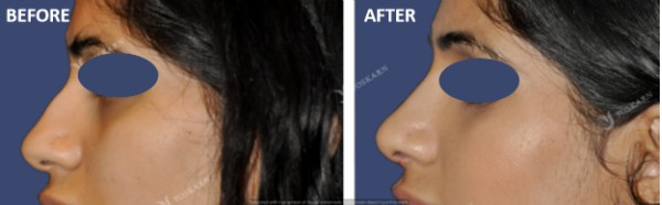 Rhinoplasty Clinic Thailand  and dermatology center