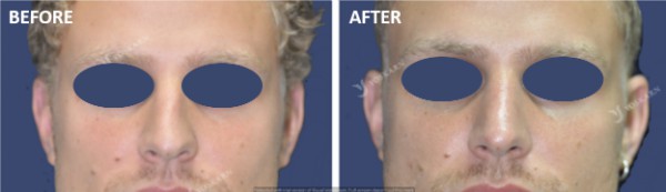 Rhinoplasty Clinic Thailand  and dermatology center