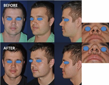 Rhinoplasty Clinic Thailand  and dermatology center