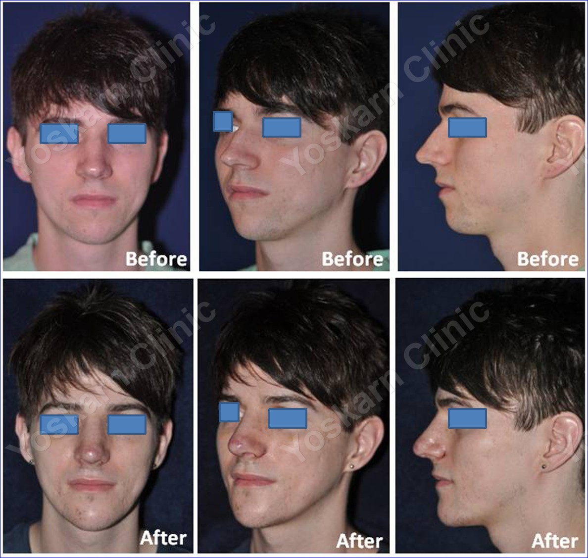 Rhinoplasty Clinic Thailand  and dermatology center