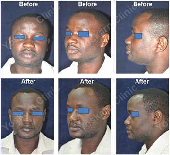 Rhinoplasty Clinic Thailand  and dermatology center