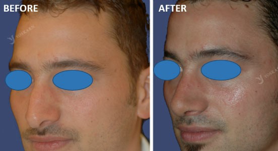 Rhinoplasty Clinic Thailand  and dermatology center