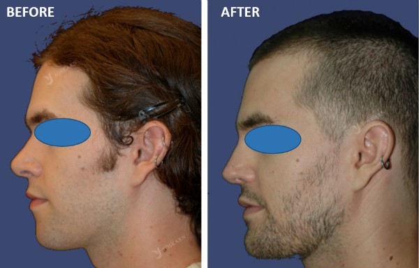 Rhinoplasty Clinic Thailand  and dermatology center